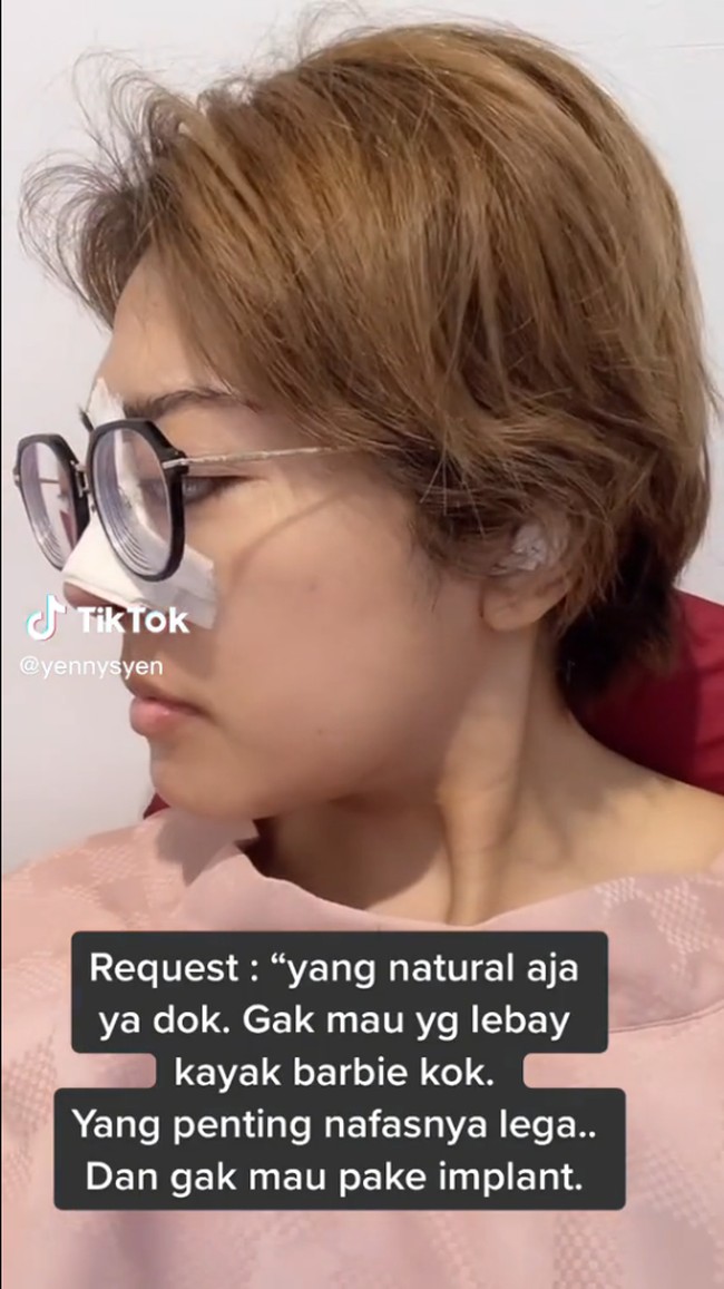 Mengundang banyak komentar, Yenny menjawab pertanyaan netizen yang menganggap jika tidak ada perubahan signifikan pada hidungnya. Ia pun menjelaskannya dengan menujukkan sejumlah foto.Foto: Instagram/TikTok @yennysyen