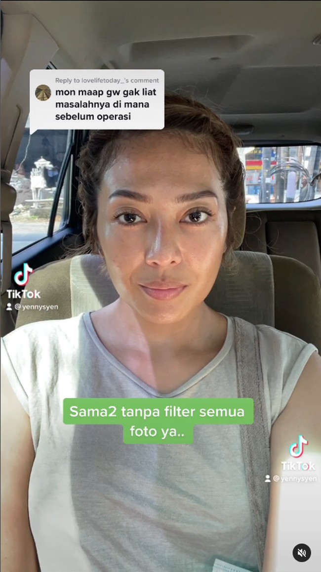 Yenny AFI mengaku bahwa ia telah menjalani operasi plastik untuk memancungkan hidungnya. Wanita tersebut bahkan tidak ragu untuk menampilkan transformasi sebelum dan sesudah oplas.Foto: Instagram/TikTok @yennysyen