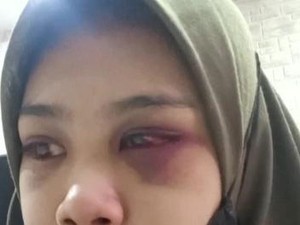 Istri di Mojokerto Babak Belur Dihajar Suami gegara di-VC Teman Pria