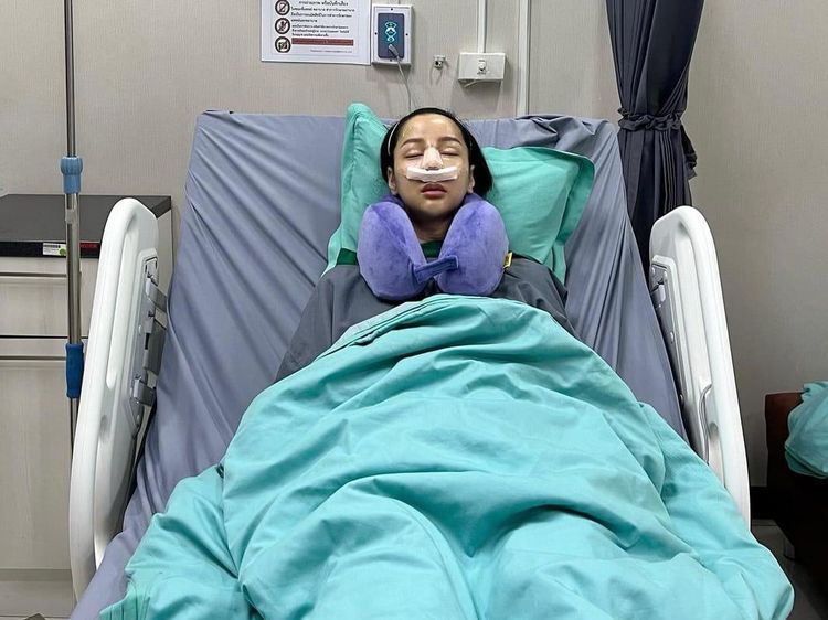 6 Foto Before-After Wajah Baru Lucinta Luna Pasca Oplas Hidung Lagi