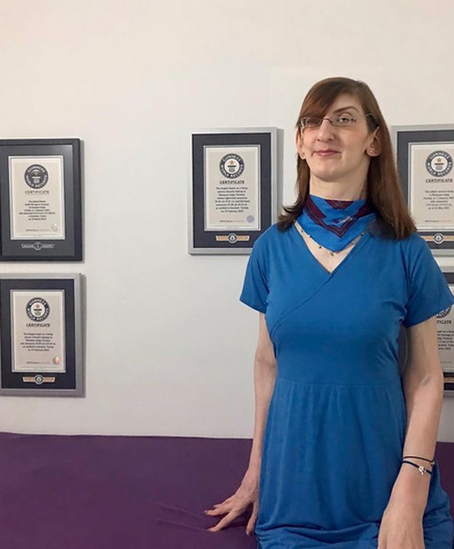 Kondisinya itu disebut sebagai Weaver Syndrome. Di mana, Rumeysa juga memiliki sekrup di tulang belakangnya sehingga dia tidak bisa duduk dan berjalan lebih dari dua jam. Foto: dok. Instagram/@rumeysagelgi