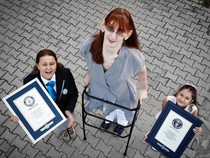 Potret Rumeysa Gelgi, Punya Tinggi Lebih 2 Meter gegara Penyakit Langka