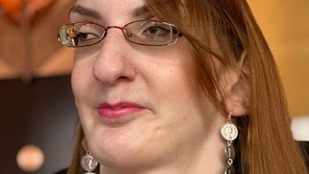 Dia memiliki kondisi yang disebut sindrom Weaver. Sindrom tersebut menyebabkan pertumbuhan yang cepat dan kelainan bentuk tulang. Karena kondisinya, dia hanya bisa berdiri dengan bantuan alat bantu jalan. Foto: dok. Instagram/@rumeysagelgi