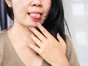 Sariawan Tak Kunjung Sembuh? Bisa Jadi Tanda Imun Lemah