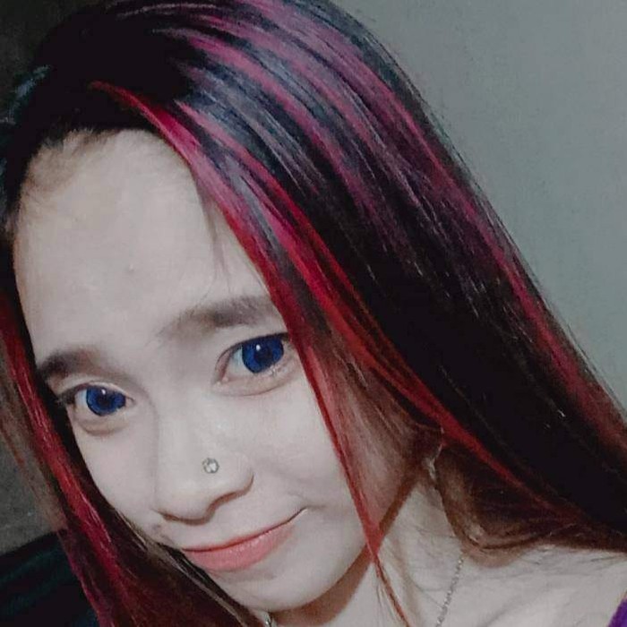 YS, wanita muda yang memiliki kelainan seksual. (Foto: Istimewa)
