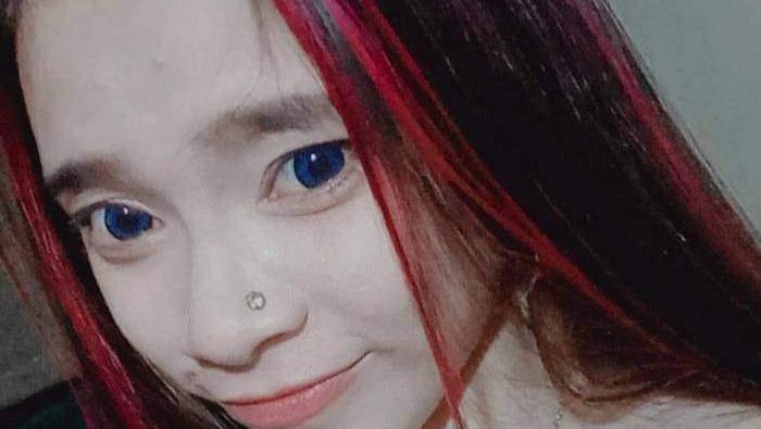 YS, wanita muda yang memiliki kelainan seksual. (Foto: Istimewa)