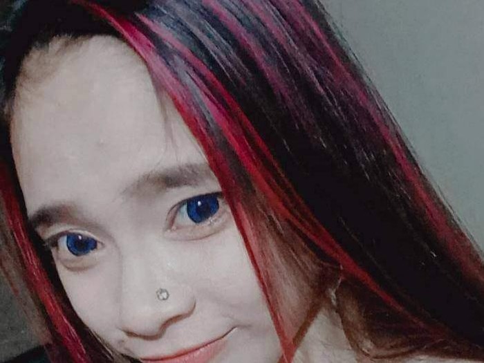 YS, wanita muda yang memiliki kelainan seksual. (Foto: Istimewa)