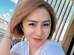 8 Potret Femmy Permatasari Jalani 6 Oplas Dalam Sehari, Wajah Bengkak-Lebam