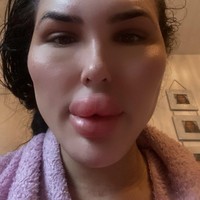 Sofia Lips ingin punya bibir terbesar di Inggris sebelum mencapai targetnya sebagai pemiliki bibir terbesar di dunia. Sejauh ini, ukuran bibirnya sudah membesar hampir dua kali lipat. Foto: Instagram Sofia Lips