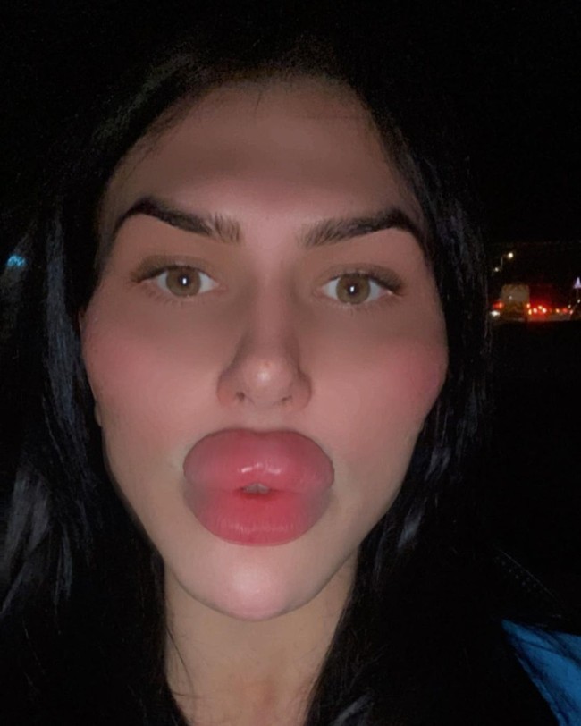 Wanita yang dikenal sebagai Sofia Lips mengaku terobsesi dengan penampilan hingga hobi operasi plastik. Salah satu tujuannya melakukan berbagai prosedur adalah untuk memiliki bibir terbesar di dunia. Foto: Instagram Sofia Lips