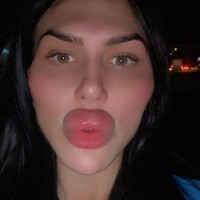 Wanita yang dikenal sebagai Sofia Lips mengaku terobsesi dengan penampilan hingga hobi operasi plastik. Salah satu tujuannya melakukan berbagai prosedur adalah untuk memiliki bibir terbesar di dunia. Foto: Instagram Sofia Lips