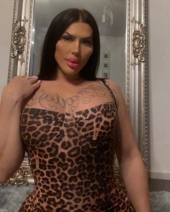 Dia bilang aku terlalu banyak operasi jadi harus menunggu tahun depan. Aku tidak dibilang tidak punya banyak lemak untuk melakukan operasi ini jadi aku harus menunggu lima bulan dan melihat kondisinya. Aku harus mencari dokter lain selagi makan makan sebisa mungkin tapi sulit untuk menggemukan diri, kata wanita yang pernah 15 minggu tidak bisa duduk karena operasi bokong itu. Foto: Instagram Sofia Lips