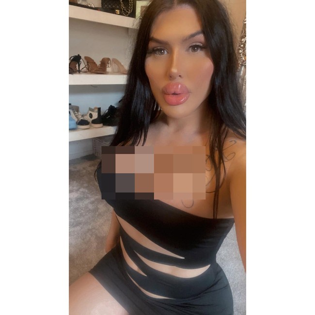 Punya bibir terbesar di UK adalah gelar yang hanya diberikan kepadaku tapi aku suka memilikiknya dan sekarang aku ingin punya bibir terbesar di dunia, katanya dilansir NeedToKnow. Foto: Instagram Sofia Lips