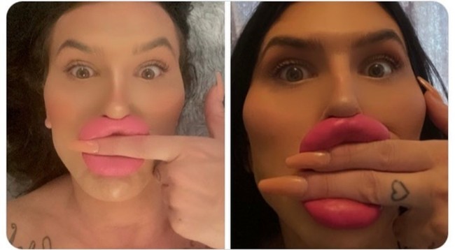 Sudah pernah operasi bokong, Sofia mengaku belum puas dengan penampilannya dan berniat untuk menjalani BBL yang ketiga kali. Tapi sayangnya hal itu belum bisa dilakukan karena ia diblokir oleh dokter bedah dan bahkan masuk daftar orang yang dilarang untuk operasi plastik. Foto: Instagram Sofia Lips