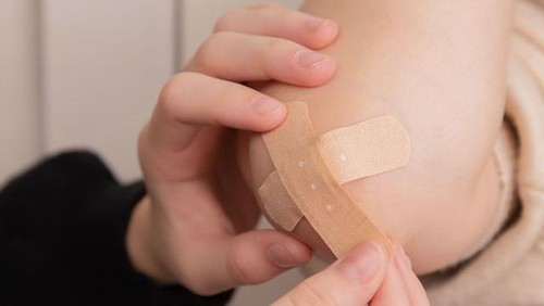 Fase penyembuhan luka.