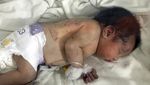 Potret Pilu Bayi Baru Lahir Selamat dari Reruntuhan Gempa di Suriah