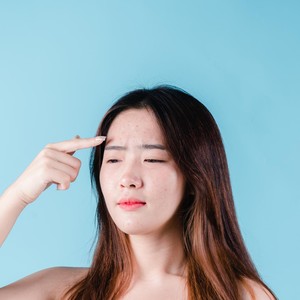 11 Cara Mencegah Jerawat Agar Kulit Wajah Selalu Mulus 11 Cara Mencegah Jerawat Agar Kulit Wajah Selalu Mulus