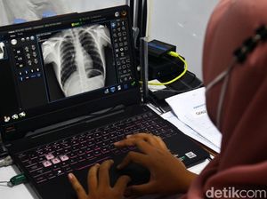 Deteksi Dini Penyakit Tuberkulosis