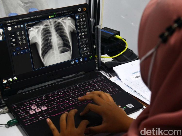 Deteksi Dini Penyakit Tuberkulosis