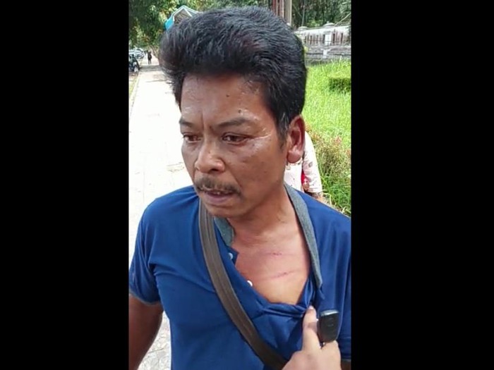 Immanuel, warga Sibolangit yang mengalami luka memar diduga akibar dianiaya pria ngaku paspampres (Foto: Istimewa)