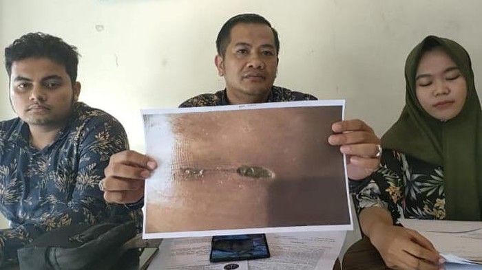 Keluarga pasien kelamin membusuk menunjukkan bukti foto dugaan malpraktik. (Foto: Istimewa)