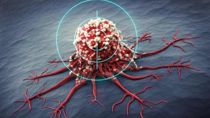 Studi Temukan Lebam Kehijauan di Tangan Bisa Jadi Tanda Tumor Langka