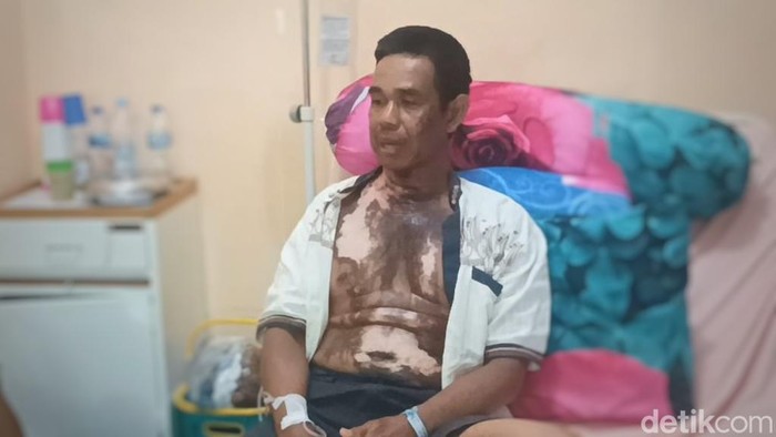 Mantan Kades Tanah Priuk, Musi Rawas, Sumsel disiram air keras.