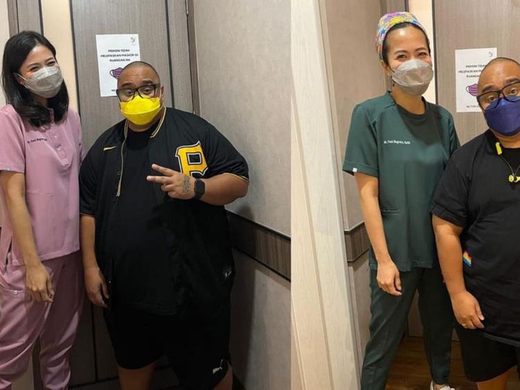 Saykoji Sukses Pangkas BB hingga 21 Kg, Begini Potret Perjalanan Dietnya