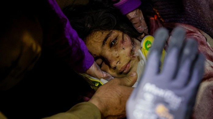Bertahan 6 Hari di Reruntuhan, Gadis Ini Berhasil Diselamatkan SENSITIVE MATERIAL. THIS IMAGE MAY OFFEND OR DISTURB Rescuers attend to survivor Zeynep Ugurlu, 11, in the aftermath of a deadly earthquake, in Hatay, Turkey February 12, 2023. REUTERS/Kemal Aslan