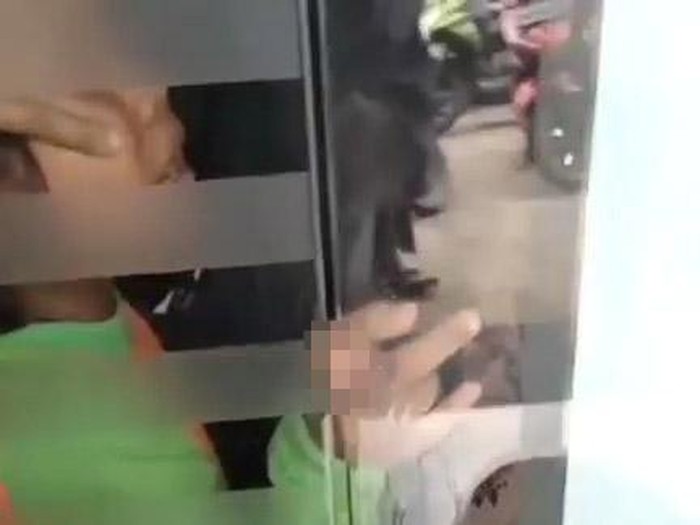 Siswi TK yang jari tangannya terjepit pintu kaca ATM