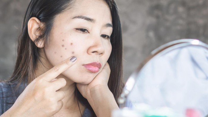 unhappy Asian woman checking her face skin problem with dark spot from scar acne