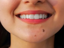 56 Letak Tahi Lalat dan Artinya Menurut Primbon Jawa