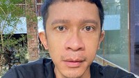 Penampilan Aming ini disebut membuatnya menjadi lebih ganteng. Foto: instagram
