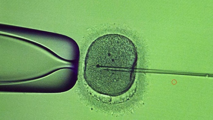 A doctor conducts the procedure of intracytoplasmic sperm injection (ICSI) at the laboratory of the IVMED fertility clinic in Kyiv, Ukraine, Tuesday, Jan. 31, 2023. Some Ukrainian soldiers are turning to the process of freezing sperm as they face the possibility that they might never go home. (AP Photo/Roman Hrytsyna)