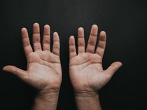 Telapak Tangan Mudah Berkeringat Gejala Punya Penyakit Jantung? Gini Kata Dokter