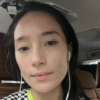 Dalam keterangan unggahannya Tatjana mengaku sudah mengalami permasalahan jerawat selama lebih dari 10 tahun. Perjalanannya untuk sembuh dari jerawat itu tak mudah, harus melewati saat-saat surut ketika jerawatnya mulai mereda, dan saat-saat naik, ketika jerawat-jerawatnya kembali muncul. Foto: Instagram/@tatjanasaphira