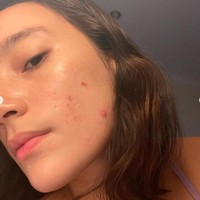 Tampil polos tanpa pulasan makeup, Tatjana tetap percaya diri memamerkan wajahnya yang berjerawat. Meski berjerawat namun tak sedikit yang memujinya tetap cantik. Foto: Instagram/@tatjanasaphira