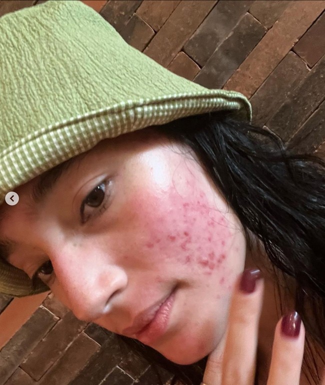 Unggahan Tatjana Saphira pun banjir beragam dukungan dari masyarakat dan rekan sesama artisnya. Youre so brave thank you for sharing this honest yet powerful message. You’re amazing, komentar Pevita Pearce. Foto: Instagram/@tatjanasaphira