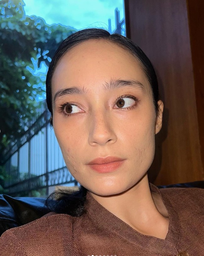 Tentunya ada banyak suka dan duka yang telah dilewati Tatjana selama perjuangannya melawan jerawat. Terlebih sebagai publik figur dirinya selalu dituntut untuk bisa tampil sempurna. Foto: Instagram/@tatjanasaphira