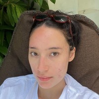 Kini jerawat di wajah Tatjana pun perlahan sudah mulai membaik dan tak sebanyak dulu. Foto: Instagram/@tatjanasaphira