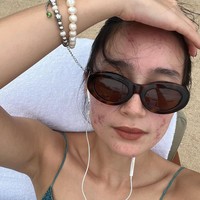 Melalui akun Instagram pribadinya Tatjana terlihat kembali memamerkan wajahnya yang berjerawat dengan penuh percaya diri. Diketahui bahwa itu bukanlah yang pertama, sebelumnya Tatjana juga sudah pernah membahas mengenai permasalahan jerawat yang dialaminya. Foto: Instagram/@tatjanasaphira