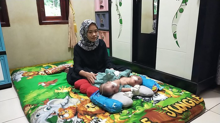 Ibu Bayi Kembar Siam di Lebak, Ida Parwati