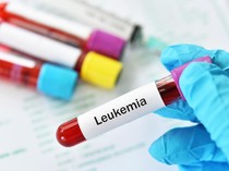 Leukemia Jadi Jenis Kanker Terbanyak pada Anak RI, IDAI Bicara Pemicunya