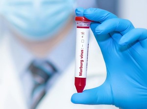 Wabah Virus Marburg Landa Negara Ini, WHO Laporkan Sudah 8 Orang Tewas