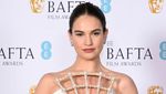 Kerangkeng Berkilau di Dada Lily James, Lihat 5 Potretnya!