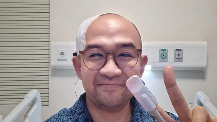 Iwet Ramadhan Kena Perdarahan Selaput Otak, Badan Sebelah Kiri Melemah