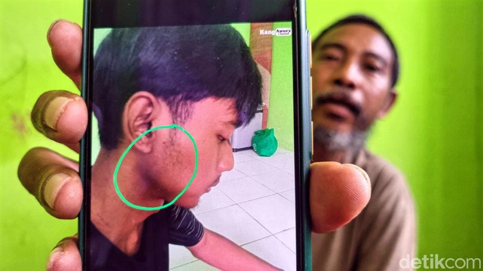 Wahyudin menunjukan luka di kepala keponakannya