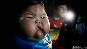 Potret Kenzie Si Bayi Viral Obesitas di Bekasi, Umur Setahun Beratnya 27 Kg