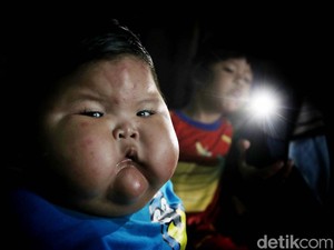 Fakta-fakta Bayi Obesitas di Bekasi, Kondisi Terkini hingga Dugaan Penyebab