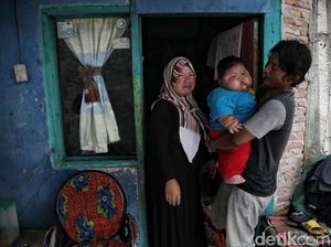 Bayi Obesitas 27 Kg di Bekasi Bakal Diperiksa Dokter Gizi Besok